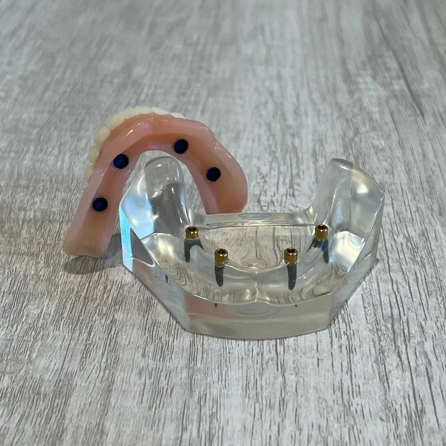 snap-in implant dentures CITY, STATE